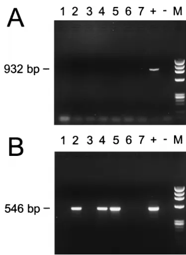 TABLE 1. Results of serologic and PCR assays for acute-phasesamples collected from suspected HGE patientsresiding in Westchester County, N.Y.