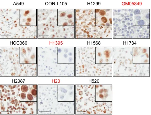 Figure 6: ATM protein expression in NSCLC cell lines assessed by immunohistochemistry