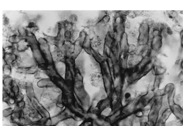 FIG. 1. Brain abscess showing a radiating pattern of hyphae. Gomori methenamine silver stain; magniﬁcation, �128.