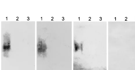 FIG. 1. Multiplex PCR analysis of fecal cultures from HUS patients andSTEC isolates. Crude DNA extracts of broth cultures from the indicated samples