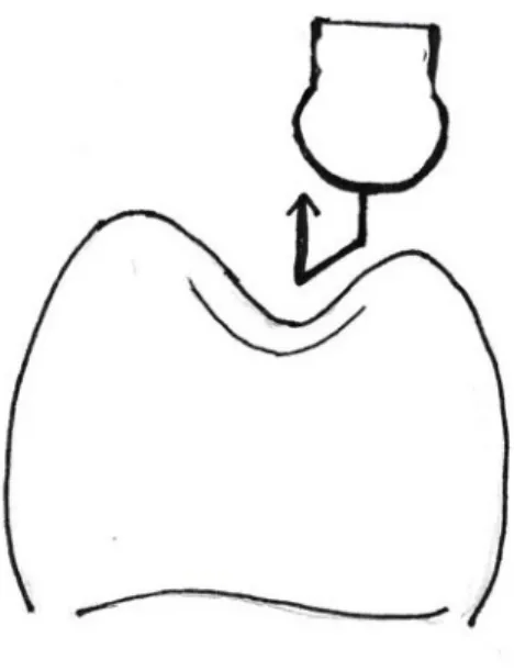 Figure 2.3. Schematic diagram of mechanical loading pattern 