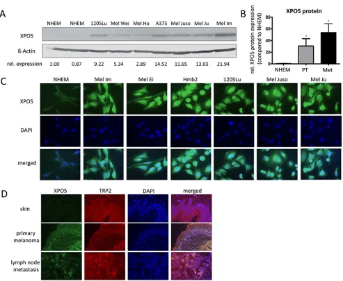 Figure 1: XPO5 protein expression in NHEMs, melanoma cell lines and tissue samples. A