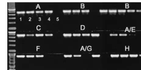 FIG. 1. Sensitivity of gp41 M/O primers in detecting HIV-1 group M sub-types A to H near-full-length molecular reference clones