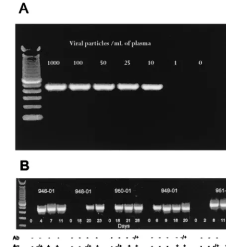 FIG. 2. Sensitivity of gp41 M/O primers in detecting HIV-1 RNA in plasmawith known copy numbers (A) and early seroconverters (B)