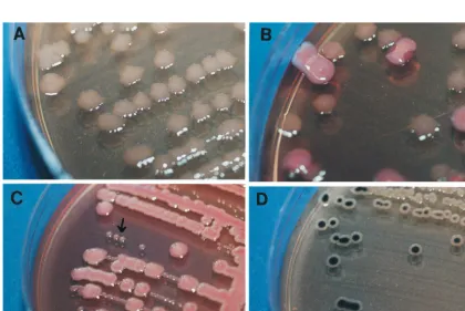 TABLE 2. Differentiating reactions produced by the SSI enteric medium and possible identity of the pathogenic bacteria