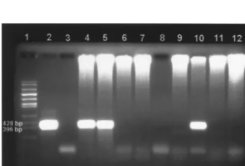 TABLE 2. Collection type, test results, and percent agreement between PCR and mouse inoculation assays
