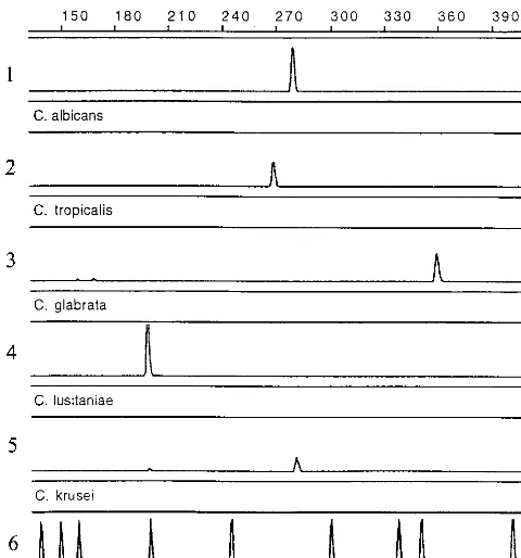 FIG. 4. Electropherograms of ﬁve CandidaPRISM 310 genetic analyzer. Control strains (graphs 1 to 5) were ampliﬁed byusing ITS4 and ﬂuorescently labeled ITS86 and dUTP as described in Materialsand Methods