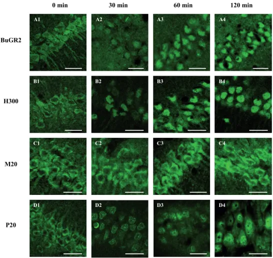 Figure 3 |   GR nuclear translocation patterns in rat CA1 cells. Time curve analysis of  subcellular distribution  of  GR-IR in CA1 cells of  ADX rat hippocampus at 0, 30, 60 and 120 min after 3 mg/kg corticosterone injection