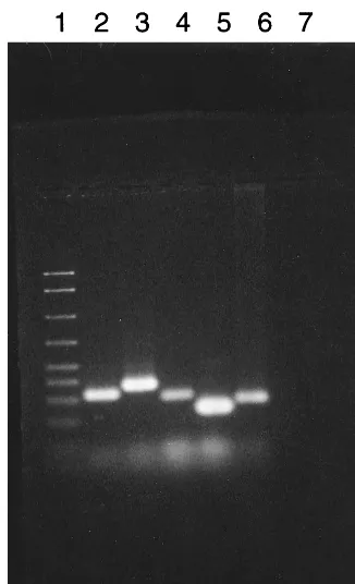 FIG. 2. Restriction enzyme digestion pattern of the second-step PCR products. Five microliters of the second-step products was digested with 1 U of Hinlanes 4,VspVspdIII orI, electrophoresed in a 2% agarose gel, and stained with ethidium bromide