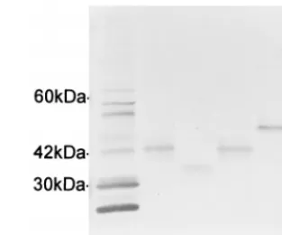 FIG. 4. Western immunoblot reacted with anti-E. chaffeensis HMAF showingthe proteins expressed by three different size variations of the VLPT gene