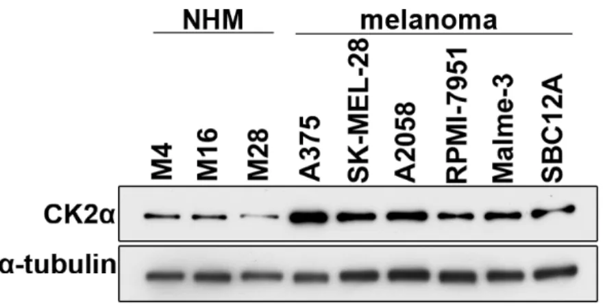 Figure 2.1. CK2α protein expression is elevated in melanoma cell lines compared to  normal human melanocytes (NHM)