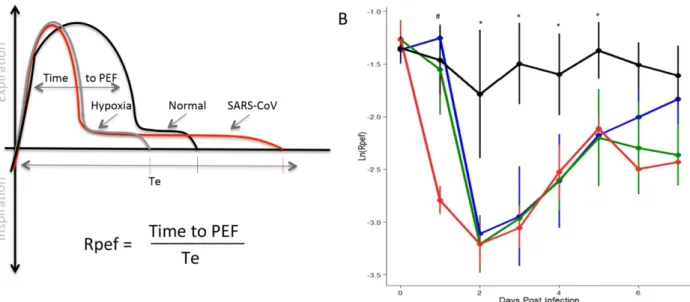Fig 4. The shape of the exhalatory flow curve (Rpef) indicated changes following infection with SARS-CoV