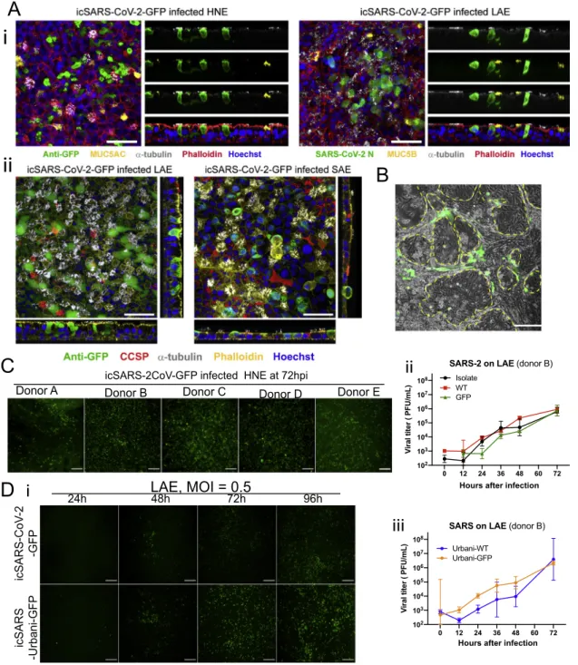 Figure S4. Additional data of SARS-CoV and SARS-CoV-2 infected primary human cells, related to Figure 6