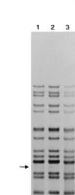 FIG. 3. IS6110pattern of pure DNA of one SCC. Lanes 2 to 21 depict patterns of mixtures of this DNA with an increasing amount of DNA of another SCC containing an additionalIS6110 RFLP patterns of different mixtures of the DNAs of two SCCs of an M