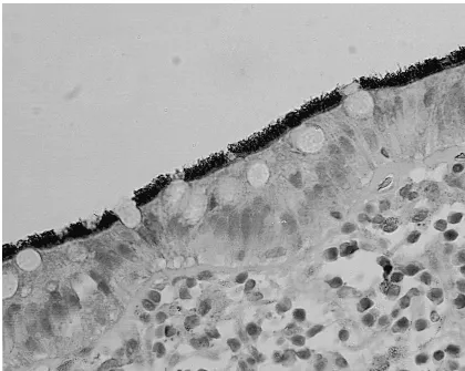 FIG. 2. Upon immunostaining the microorganisms are seen to react with the spirochete antiserum, producing a marked contrast with the fringe detected over thecolonic mucosal surface