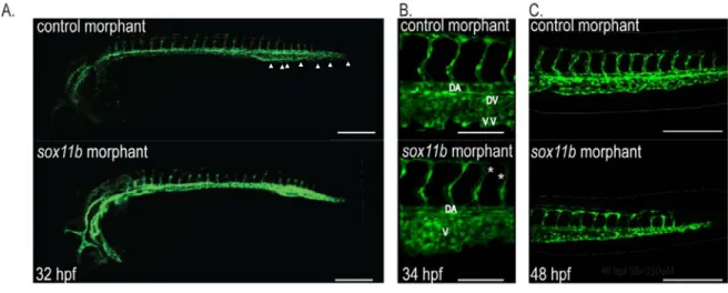 Figure 2.4:  sox11b regulates sprouting angiogenesis during development. 