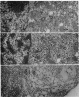 FIG. 3. Electron micrographs of controls for the immunogold labeling technique. (A) Nef- cells were incubated with polyclonal anti-Nef antiserum followed by gold-conjugated anti-rabbit antibody.