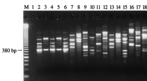 TABLE 2. Sensitivity levels achieved by the 40-cycle PCR assaywith PBS or urine specimens spiked with various amountof S