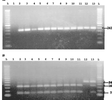 FIG. 5. Detection and differentiation of PCV infections by a PCR-RFLP assay. (A) Results of PCR ampliﬁcation of a 243-bp fragment from tissue samples thatcontained PCV isolates (both PCV-1 and PCV-2) but not from a negative control liver tissue sample (lan