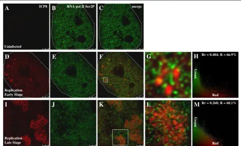 Fig. 5 Double immunostaining of ICP8 and RNA Pol II Ser2P. Experimental group cells were infected with HSV-1 17+ strain for 6 h, then fixed forCells were infected at a MOI of 0.1 PFU/cell, images are captured with STED microscopy and then analyzed.PFU/cell