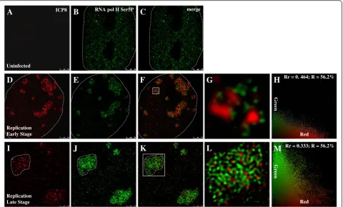 Fig. 6 Double immunostaining of ICP8 and RNA Pol II Ser5P. Experimental group cells were infected with HSV-1 17+ strain for 6 h, then fixed forCells were infected at a MOI of 0.1 PFU/cell, images are captured with STED microscopy and then analyzed.PFU/cell