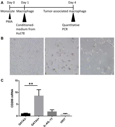 Figure 4: T lymphoma cells promote M2-type macrophage differentiation through a GATA3-dependent mechanism
