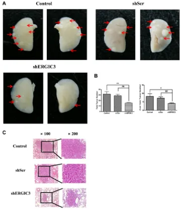 Figure 4: shERGIC3 suppresses lung tumorigenesis in K-rasLA1 mice. Aerosols of GPT-SPE/shERGIC3 complexes were delivered to K-rasLA1 mice twice a week for 4 weeks (eight times)