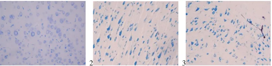 Figure 2 shows the microslide of kidney of a rat with hemorrhagic stroke. The 