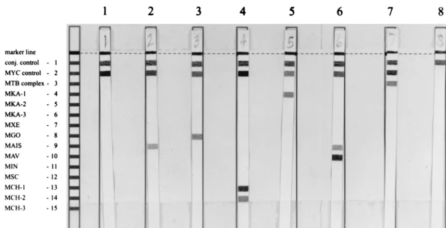 FIG. 1. Representative examples of results of the LiPA MYCOBACTERIA assay. The positions of the conjugate (conj.) control, Mycobacteriumcomplex; MAV,control, and the 13 speciﬁc probes are shown on the left