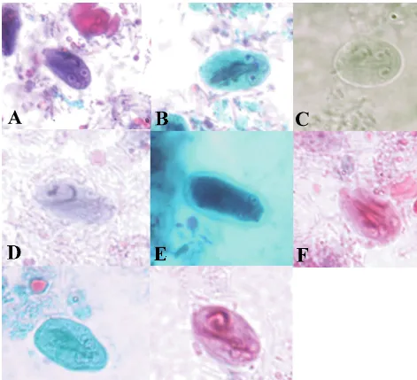 FIG. 3. Images of Giardia intestinalisEcostain (B), SAF stained with iron hematoxylin (C), STF stained with Wheatley’s trichrome (D), Parasafe stained with Wheatley’s trichrome (E), and Proto-ﬁx stainedwith Trichrome-Plus (F)