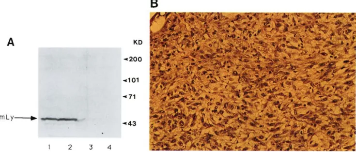 Figure 7.  (A} Western blot analysis of NIH-3T3 cells expressing LYAR cDNA. Cell extract from 106 NIH-3T3 cells expressing LYAR  cDNA Vlyl2 (lane  1) and Vly36 (lane 2) and cells expressing the neomycin gene Vneo45  (lane 3), and AC6 {bone marrow stromal c