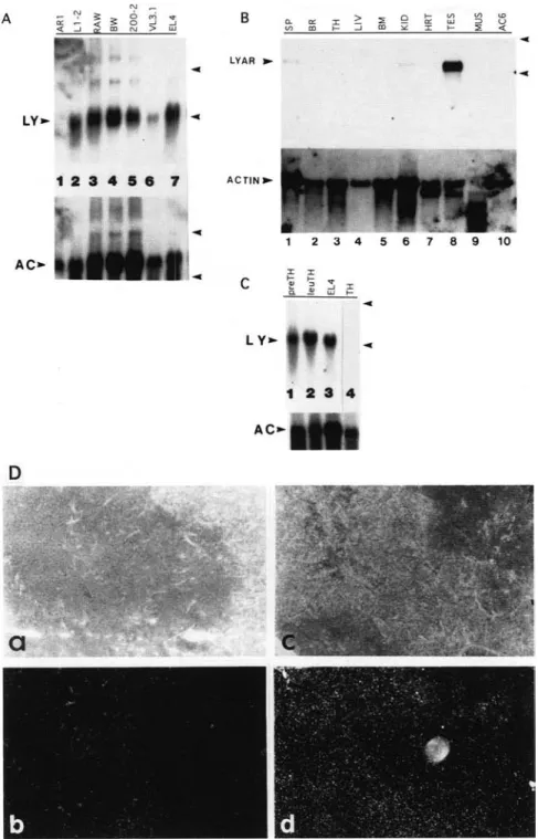 Figure  4.  Induction  of  LYAR mRNA  in  leukemia  cells  and  during  radiation-in-  duced  T-cell leukemogenesis