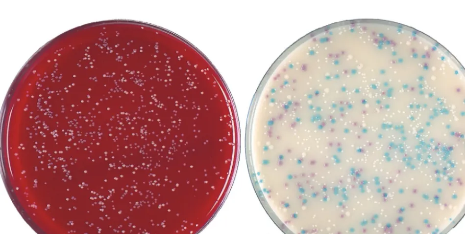 TABLE 3. Recovery of S. aureus from 2,000 clinical specimensa