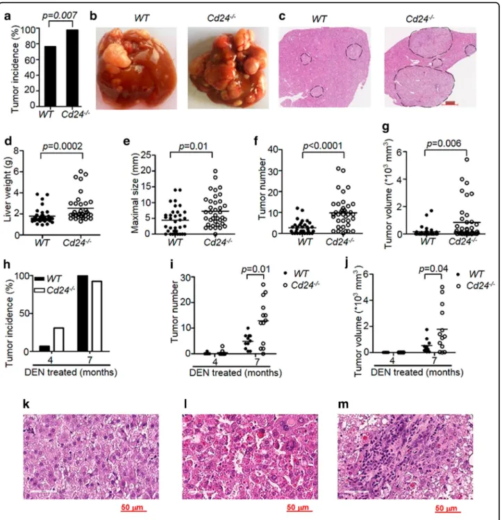 Fig. 1 Targeted mutation of Cd24 promotes the development of HCC carcinogenesis. a Incidence of HCC tumors (diameter ≥1.0 mm) in male WT (n = 34) and Cd24 −/− (n = 38) mice 8 months after 15 μg/g DEN administration to 15-day-old mice