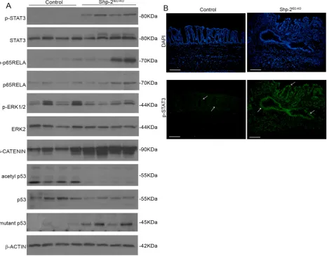 Figure 7: Aged Shp-2IEC-KO mice exhibit several typical features of colitis-associated cancer