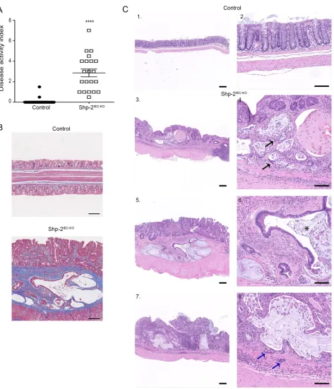 Figure 6: Mice with loss of epithelial SHP-2 expression develop colorectal adenocarcinomas with age