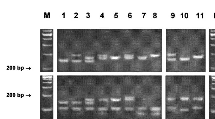 FIG. 3. Gel electrophoresis and Haeshows PCR products without restriction). The molecular sizes of the fragments are given in Fig