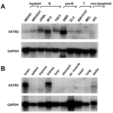Figure 11. with a (coding sequence was used in Northern blot to probe RNA isolated from various cell lines and mouse organs panelsSATB2 has a cell type and tissue-specific distribution