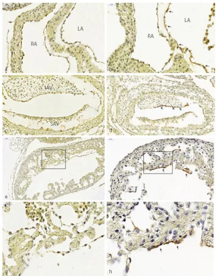Figure 2. Expression of TGFβ type III receptor. (a) Normal left and right atrium of HH20