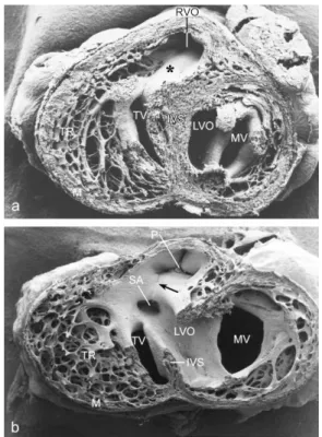 Figure  3.  SEM  of  HH34  postseptation  embryos  viewed  from  apex  to  base.  (a)  Normal  heart
