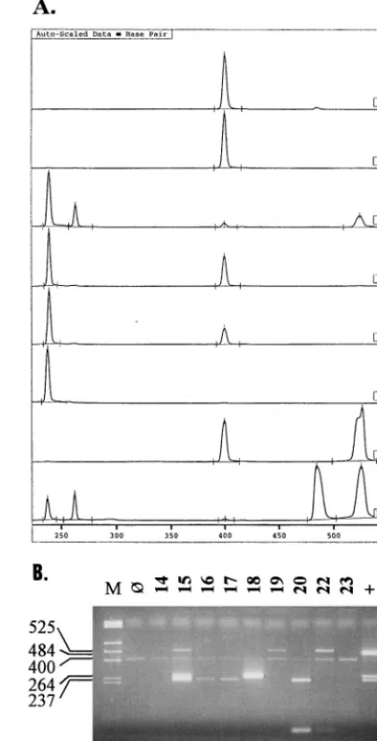 FIG. 1. Examples of an ALFexpress Fragment Manager (version 1.2) elec-tropherogram (A) and an analytical agarose gel for MEE specimens (B)