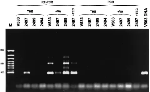FIG. 5. RT-PCR analysis of vanB(MBI Fermentas); V583 DNA, product of PCR withstrain (45)