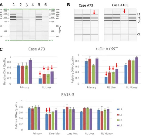 Figure 7: Detection of DNA damage in autopsy samples. (A) PCR band pattern using control DNA