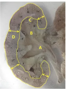 Figure 1. Left kidney cross section. A – front part, B – rear part.  