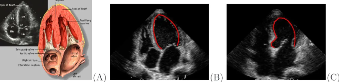 Figure 1.1: Endocardial wall segmentation in 2D echocardiogram: (A) an echocardio- echocardio-gram and the corresponding anatomical diaechocardio-gram in the A4C view (Image source: Yale atlas of echo), (B) and (C) endocardial wall segmentation of the left
