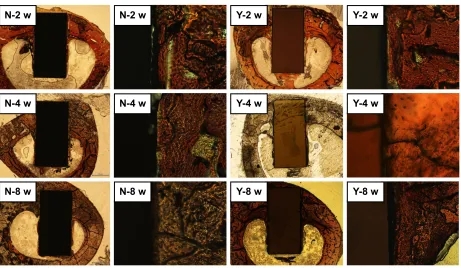 Figure 6 histological observation of NanoZr and 3Y-TZP implants after 2, 4, and 8 weeks of healing.Note: Sections were undecalcified and ground (~50 µm thickness), then stained with tartrate-resistant acid phosphatase