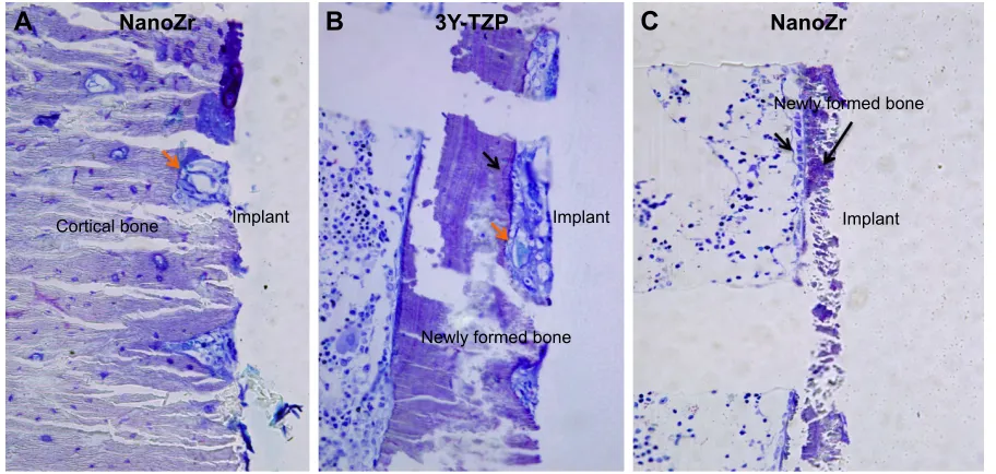 Figure 9 average thickness of newly formed bone around the surface of NanoZr and 3Y-TZP implants after 2, 4, and 8 weeks of healing within the bone marrow area.Abbreviations: NanoZr, zirconia–alumina nanocomposite; 3Y-TZP, 3 mol% yttria-stabilized tetragonal zirconia polycrystalline.
