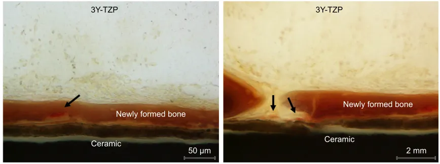 Figure 11 Tartrate-resistant acid phosphatase-stained image of an osteoclast near the 3Y-TZP implant surface after 2 weeks of healing.Note: arrows = osteoclasts.Abbreviation: 3Y-TZP, 3 mol% yttria-stabilized tetragonal zirconia polycrystalline.