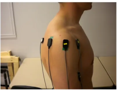 Figure 2: EMG electrode placement-Lateral view 