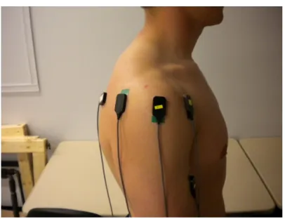 Figure 2: EMG electrode placement-Lateral view 